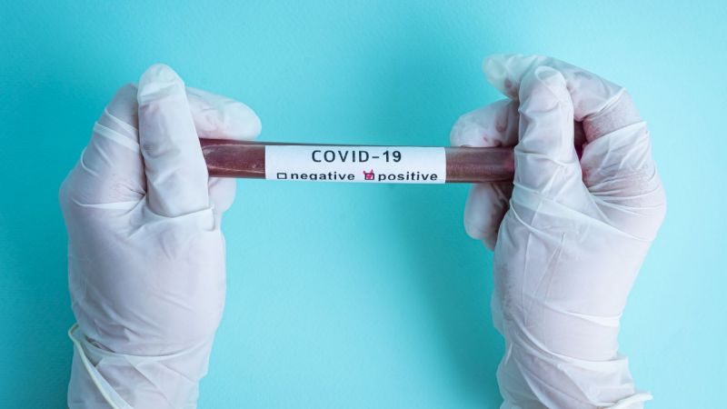 Koronavirüs Salgını Bitmeden Veba Vakası Görülmeye Başlandı | Koronavirüs salgınından en çok etkilenen Amerika Birleşik Devletleri’nde şimdi de veba vakası görüldü. 2015 yılından sonra ilk kez görülen vaka Colorado eyaletinde yaşayan bir adamda tespit edildi.