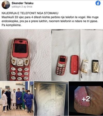 Doktor Skender Telaku Hastanın Midesinden Çıkan Fotoğrafları Facebook Hesabında Yayınladı