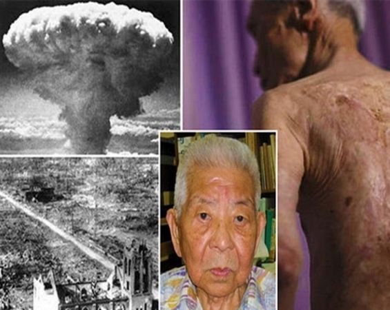 Yamaguchi 2 Atom Bombasından Değil Ama 93 Yaşında Mide Kanserinden Hayata Gözlerini Yumdu