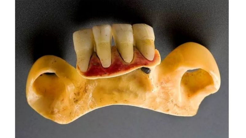 Bir Dönem Takma Diş için Gerçek Dişler Kullanıldı