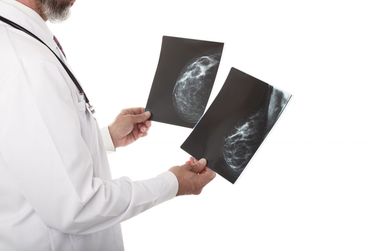 doctor-with-breast-xray-sncq2hz-1579344908.jpg