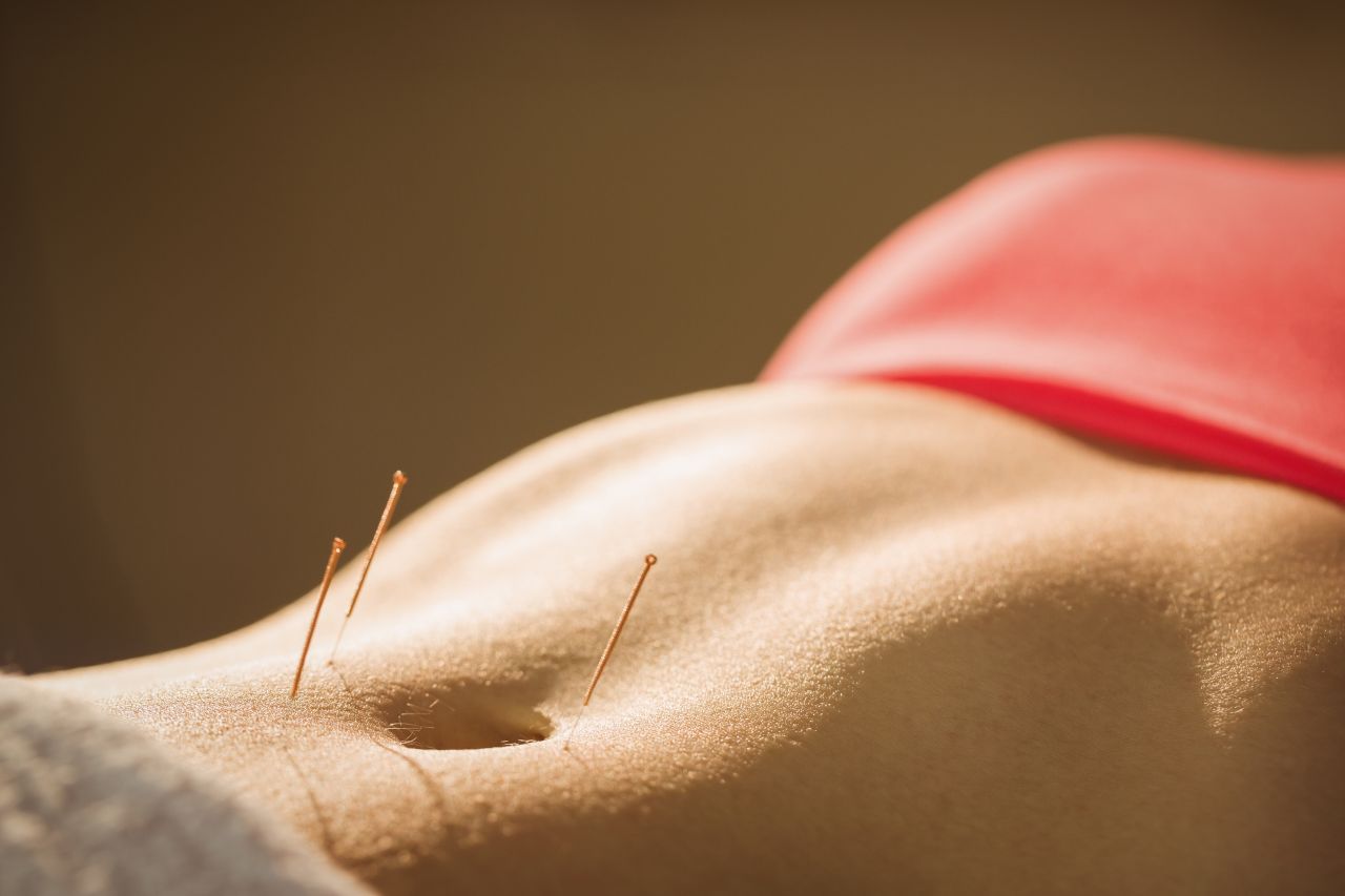 Akupunktur Nasıl Yapılır? Vücudumuzun Sihirli Noktaları Akupunktur