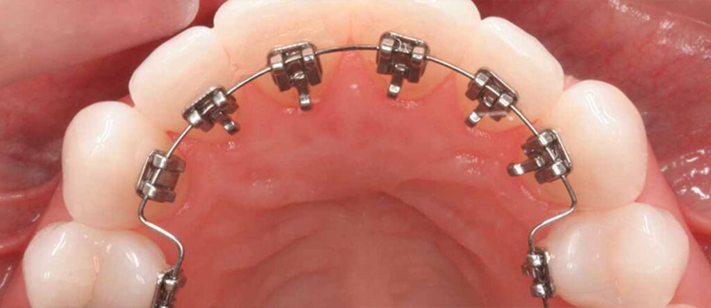Ortodonti 