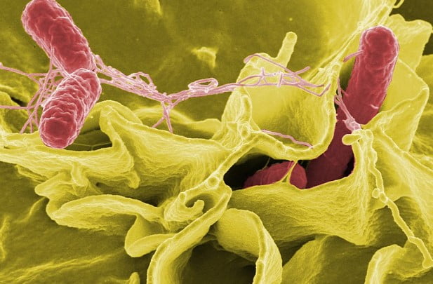7 Soruda Salmonella Hastalığı Nedir | Salmonella Nereden Bulaşır? Salmonella Nasıl Tedavi Edilir?