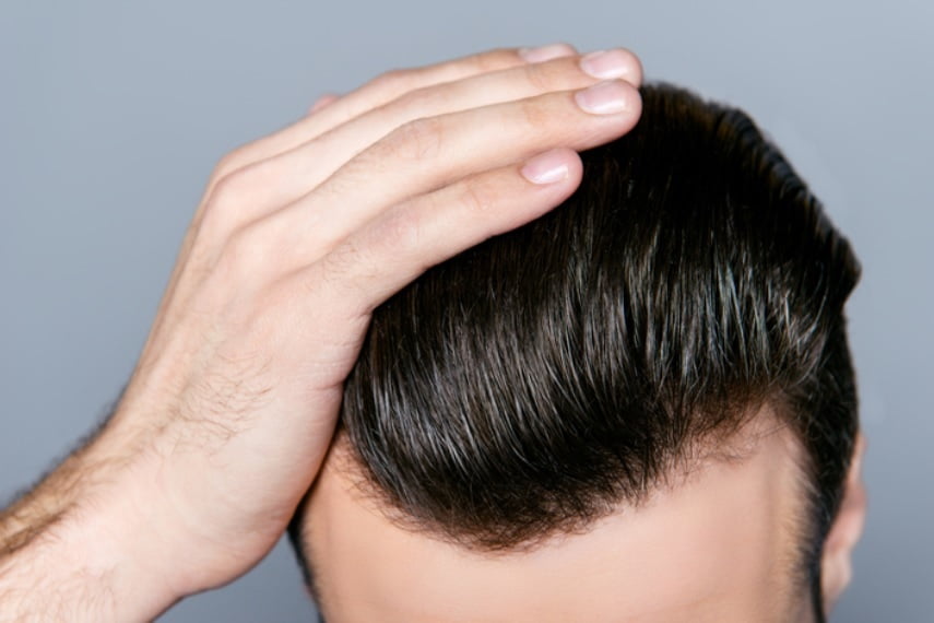 Tıraşsız Saç Ekimi Hakkında Yanlış Bilinen Gerçekler. Nasia Hair Saç Ekimi Koordinatörü Nasiye Özbek Anlatıyor…