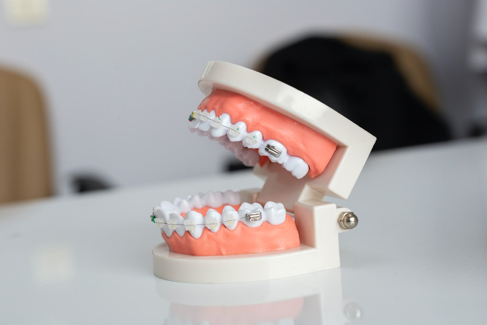 Şeffaf Diş Teli Nedir? Görünmeyen Şeffaf Diş Teli Pahalı Mı?
