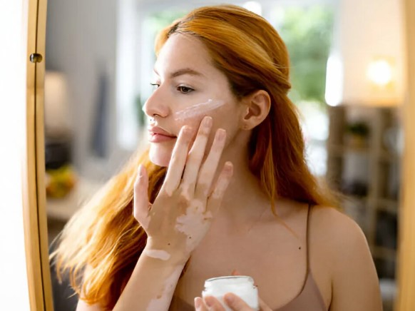  Sudocrem Yüze Sürülür mü | Sudocrem Cildi Kurutur mu? Sudocrem Faydaları Ne?