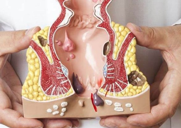 Locafen Krem Ne İşe Yarar | Locafen Krem Ne Kadar Sürede Etki Eder?