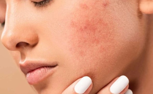 Pigmentoplus Cilt Bakım Kremi Ne İşe Yarar | Pigmentoplus Kimin Markası?