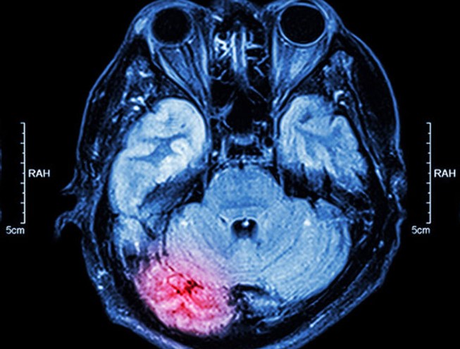 Sağlık Fizikçisi Nedir | Sağlık Fizikçisi Ne İş Yapar? Sağlık Fizikçisi Ataması Var mı?