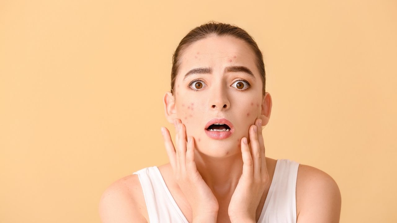 acnemix-ne-ise-yarar