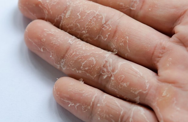 Dermifin Krem Ne İşe Yarar | Dermifin Nedir ve Ne İşe Yarar? Dermifin Fiyat Bilgisi Nedir?