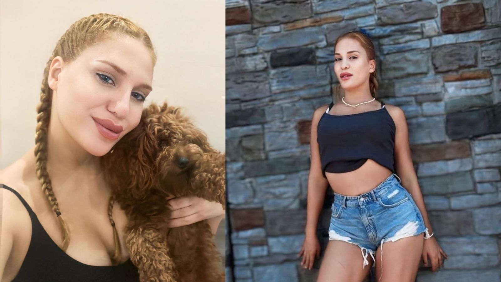 Almeda Baylan Estetik Operasyonu