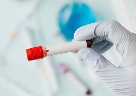 MPV Kan Değeri Nedir | MPV Yüksekliği Tehlikeli mi? 