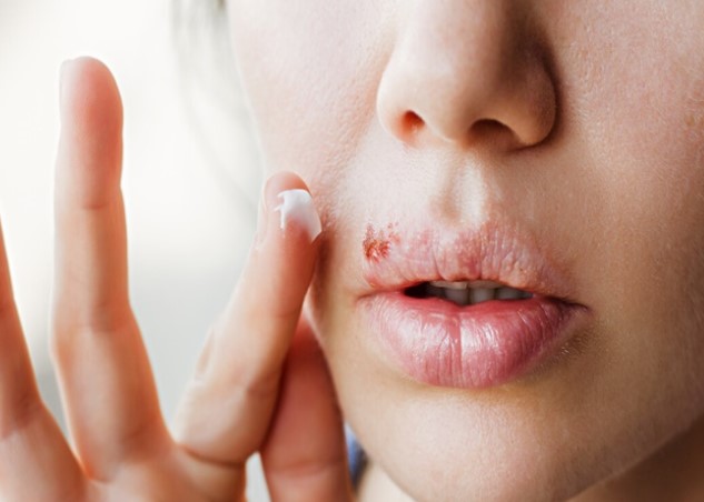 Thiocilline Krem Ne İşe Yarar | Thiocilline Krem Nerelerde Kullanılır?