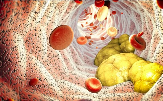Kötü Kolesterol Nasıl Düşürülür | Kötü Kolesterolü Olanlar Ne Yemeli? 