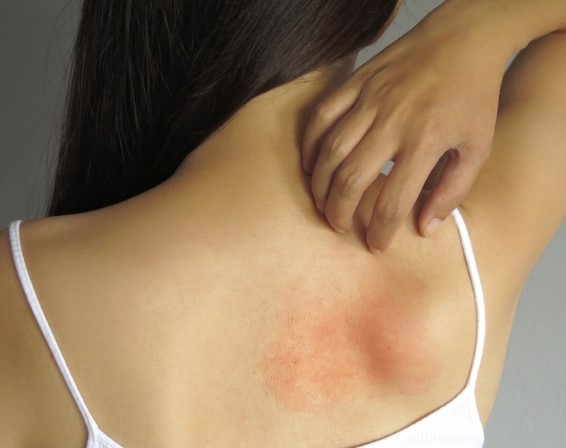 Clasem Ne İçin Kullanılır | Clasem Antibiyotik midir? Clasem Nedir? 
