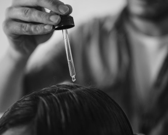 Saç Derisinde Yara ve Kabuklanma Neden Olur? Saç Dipleri Neden Yara Olur?