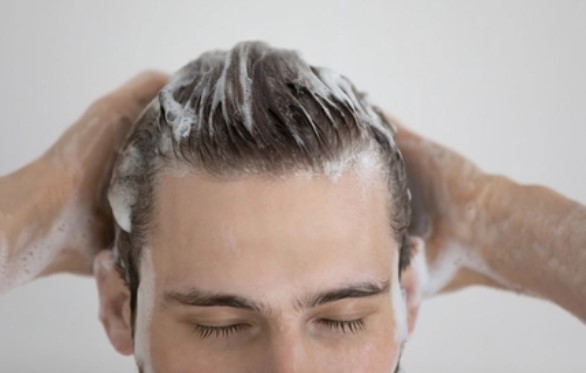 Saç Derisinde Yara ve Kabuklanma Neden Olur? Saç Dipleri Neden Yara Olur?