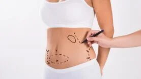 Liposuction ile Tüm İnatçı Yağlara Kısa Sürede Veda Edin