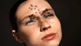 Yüzdeki Güneş Lekesi Nasıl Geçer | Pürüzsüz Bir Cilt İçin Rehber