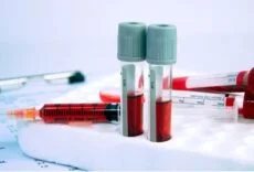 Alerji Testi İçin Hangi Doktora Gidilir | Alerji Testi Hangi Hastanelerde Var? 