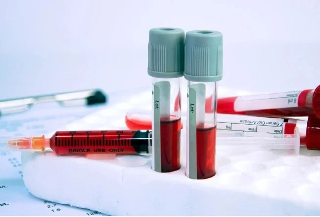 Alerji Testi İçin Hangi Doktora Gidilir | Alerji Testi Hangi Hastanelerde Var? 